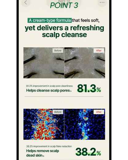 CLEAN & TREATMENT